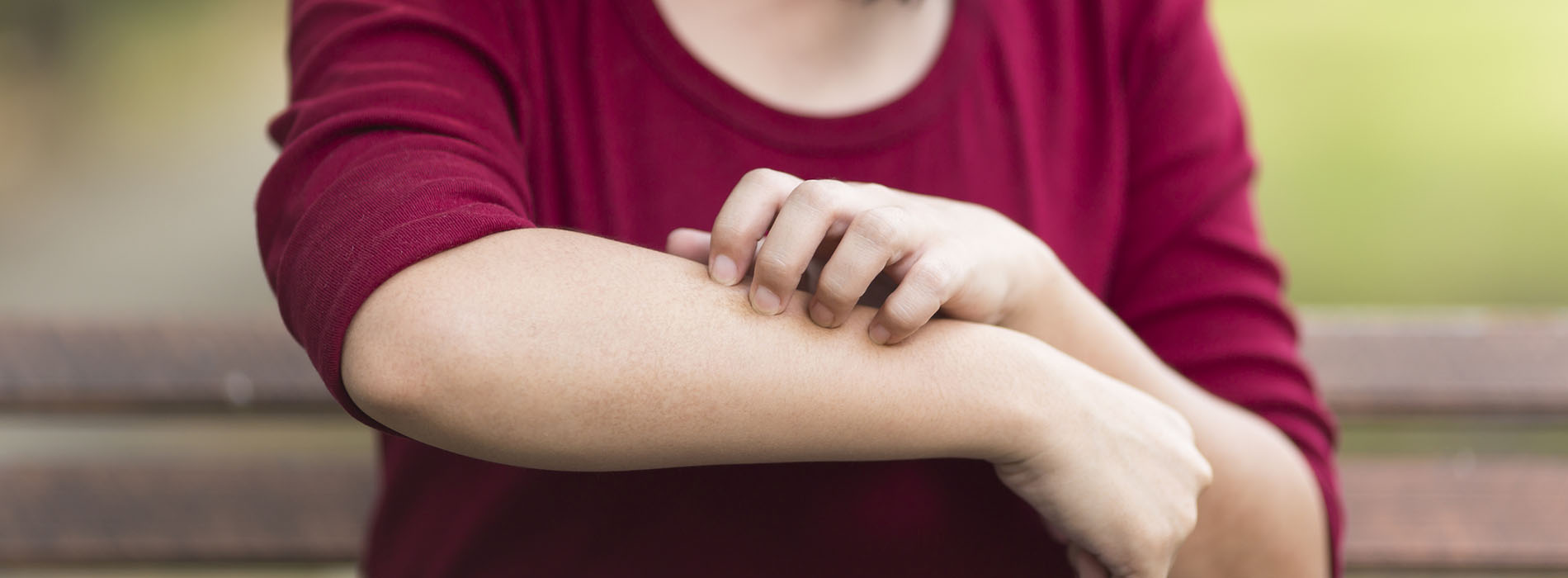 Close up of girl scratching her arm