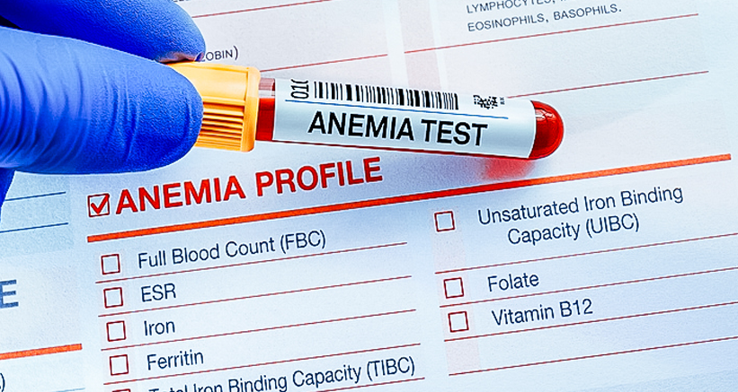 Iron deficiency testing